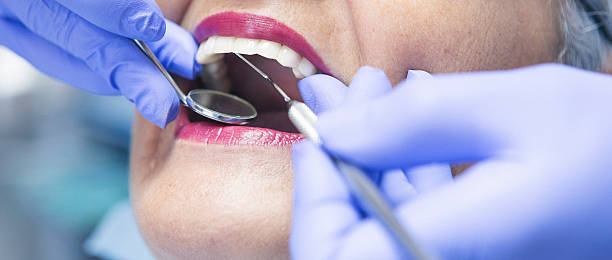 Best Emergency Gum Treatment in Darby, PA